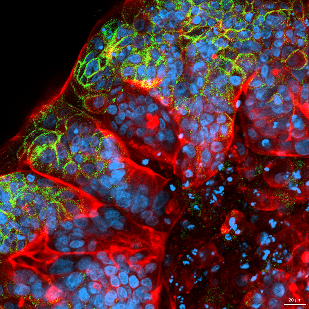 Colorectal Cosmos