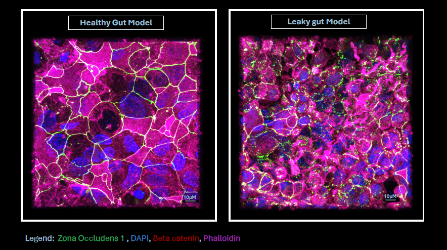 Visualizing Gut Barrier Integrity Healthy vs Leaky CaCO2 Monolayers